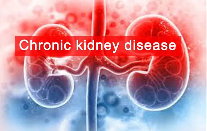 Penyebab Penyakit Ginjal Kronik (Chronic Kidney Disease)